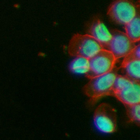 3 - Recombinant Anti-NUF2 Rabbit mAb AP95175