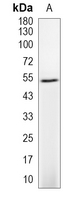 1 - Recombinant Anti-NUF2 Rabbit mAb AP95175