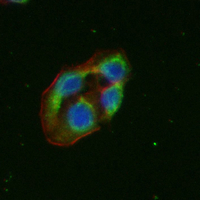 3 - Recombinant Anti-DGAT1 Rabbit mAb AP95177