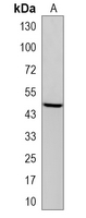 1 - Recombinant Anti-DGAT1 Rabbit mAb AP95177