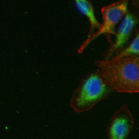 3 - Recombinant Anti-PAR2 Rabbit mAb AP95178