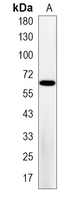 1 - Recombinant Anti-Ikaros Rabbit mAb AP95179