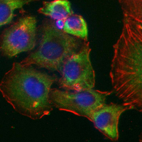 3 - Recombinant Anti-G3BP1 Rabbit mAb AP95180