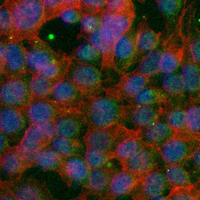 3 - Recombinant Anti-NF-1B Rabbit mAb AP95181