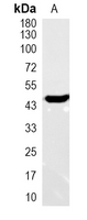 1 - Recombinant Anti-NF-1B Rabbit mAb AP95181