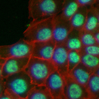 3 - Recombinant Anti-XPO1 Rabbit mAb AP95182