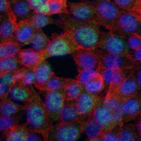 3 - Recombinant Anti-Nesprin 1 Rabbit mAb AP95183