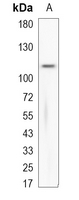 1 - Recombinant Anti-Nesprin 1 Rabbit mAb AP95183