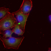3 - Recombinant Anti-HPGD Rabbit mAb AP95185