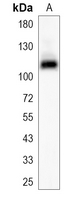 1 - Recombinant Anti-CHD1L Rabbit mAb AP95186