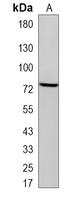 1 - Recombinant Anti-KIF2C Rabbit mAb AP95189