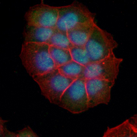 3 - Recombinant Anti-S6K2 Rabbit mAb AP95190