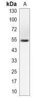 1 - Recombinant Anti-S6K2 Rabbit mAb AP95190