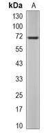 1 - Recombinant Anti-Cytochrome P450 1B1 Rabbit mAb AP95191