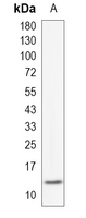 1 - Recombinant Anti-Thioredoxin 2 Rabbit mAb AP95193
