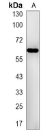 1 - Recombinant Anti-CASQ1 Rabbit mAb AP95194