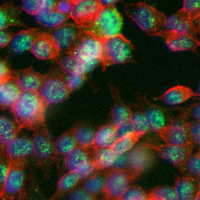 3 - Recombinant Anti-SAE1 Rabbit mAb AP95195