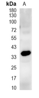 1 - Recombinant Anti-SAE1 Rabbit mAb AP95195