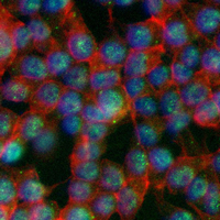 3 - Recombinant Anti-KAT8 Rabbit mAb AP95196