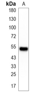1 - Recombinant Anti-KAT8 Rabbit mAb AP95196