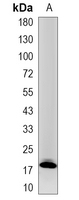 1 - Recombinant Anti-MTH1 Rabbit mAb AP95197