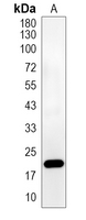 1 - Recombinant Anti-NDUFB8 Rabbit mAb AP95198