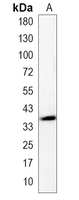 1 - Recombinant Anti-DHEA-ST Rabbit mAb AP95199