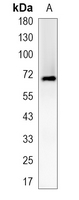 1 - Recombinant Anti-IRAK2 Rabbit mAb AP95201