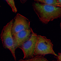 3 - Recombinant Anti-AKR1C3 Rabbit mAb AP95202