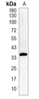 1 - Recombinant Anti-AKR1C3 Rabbit mAb AP95202