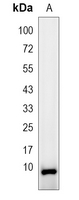 1 - Recombinant Anti-Apolipoprotein C1 Rabbit mAb AP95203