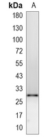 1 - Recombinant Anti-THOC4 Rabbit mAb AP95205