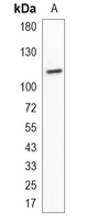 1 - Recombinant Anti-GEF H1 Rabbit mAb AP95206