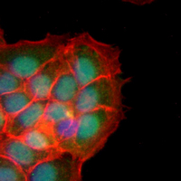 3 - Recombinant Anti-HAT1 Rabbit mAb AP95209