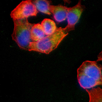 3 - Recombinant Anti-WASP Rabbit mAb AP95212