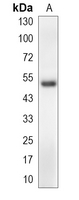 1 - Recombinant Anti-WASP Rabbit mAb AP95212