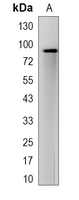 1 - Recombinant Anti-PCAF Rabbit mAb AP95213