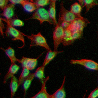 3 - Recombinant Anti-AP-2-alpha Rabbit mAb AP95214