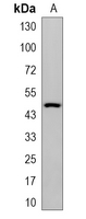 1 - Recombinant Anti-AP-2-alpha Rabbit mAb AP95214