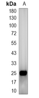 1 - Recombinant Anti-Apolipoprotein M Rabbit mAb AP95215