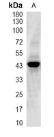 1 - Recombinant Anti-Apolipoprotein L1 Rabbit mAb AP95216