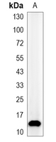 1 - Recombinant Anti-Apolipoprotein A2 Rabbit mAb AP95217