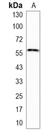 1 - Recombinant Anti-Serpin A8 Rabbit mAb AP95218