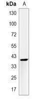 1 - Recombinant Anti-Biglycan Rabbit mAb AP95219