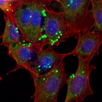 3 - Recombinant Anti-RAB27 Rabbit mAb AP95220