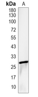 1 - Recombinant Anti-RAB27 Rabbit mAb AP95220