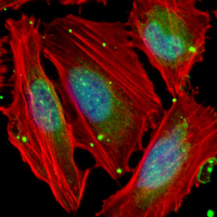 3 - Recombinant Anti-nm23-H1 Rabbit mAb AP95221