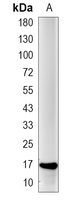 1 - Recombinant Anti-nm23-H1 Rabbit mAb AP95221