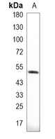 1 - Recombinant Anti-Fibrinogen gamma Rabbit mAb AP95222