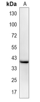 1 - Recombinant Anti-PU.1 Rabbit mAb AP95224